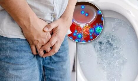 Cancerul cauzează milioane de decese în fiecare an. Cele mai frecvente tipuri de cancer la nivel mondial